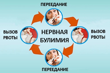 Лечение булимии в Чердаклах